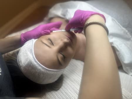 A practitioner dermaplaning a reclining client’s forehead