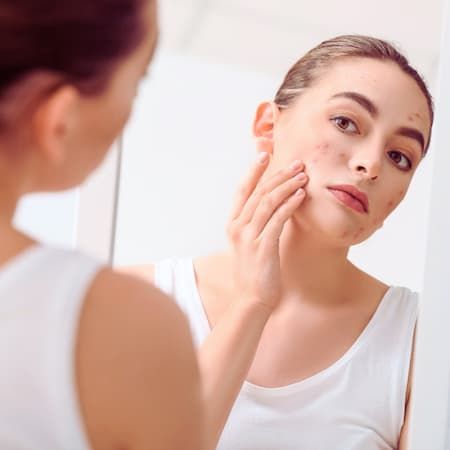 A young woman examining her skin in a mirror