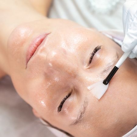 A practitioner brushing peel solution across a reclining client’s cheek