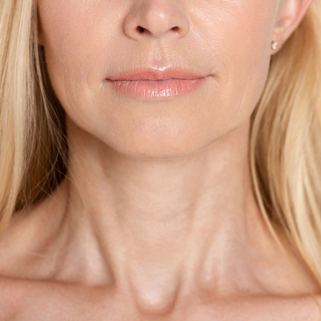 A close-up of a woman’s lower face and neck